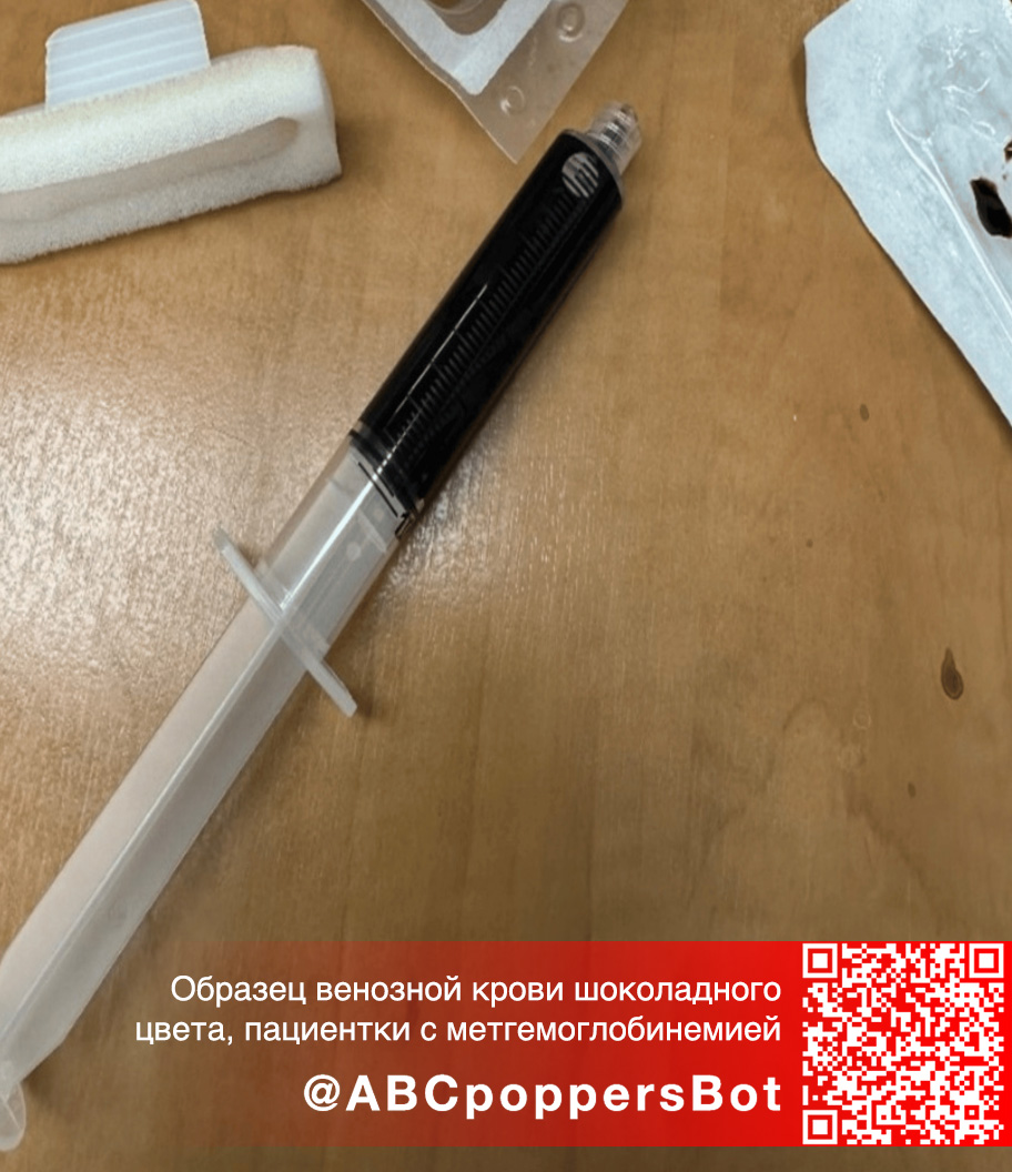 Если принять попперс внутрь в Томске это вызывает метгемоглобинемию. Смертельное состояние Если принять попперс внутрь в Томске это вызывает метгемоглобинемию. Смертельное состояние